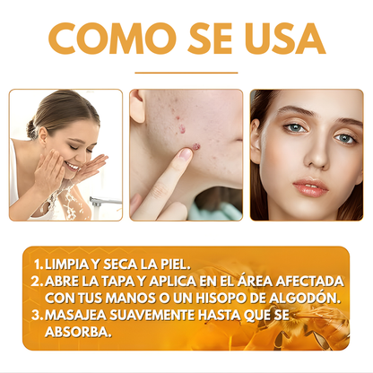 CREMA DE VENENO DE ABEJA PARA REMOVER VERRUGAS, LUNARES, MANCHAS EN LA PIEL – Corrección avanzada, renovación visible y piel más uniforme cada día