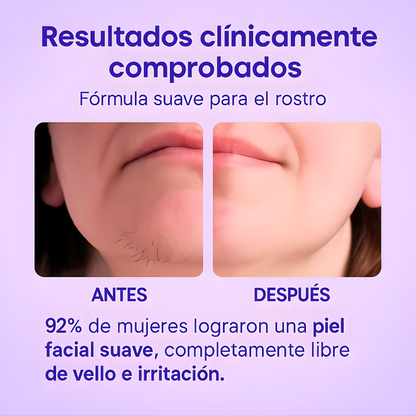 CYPERUS ROTUNDUS SKIN SERUM – Piel más uniforme, cuidado avanzado y luminosidad visible