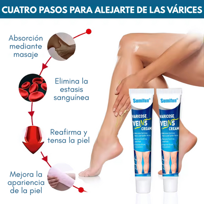 CREMA PARA VÁRICES – Alivio visible para piernas cansadas y venas marcadas