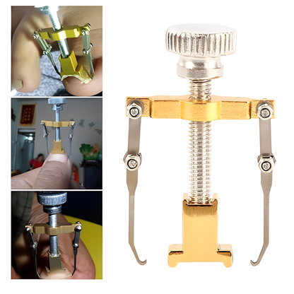 CORRECTOR DE UÑAS ENCARNADAS CON ESTUCHE METÁLICO – Alivio, precisión y cuidado profesional en casa