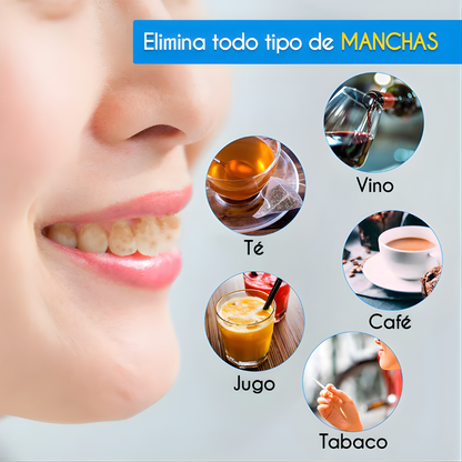 BLANQUEAMIENTO PROFESIONAL DENTAL EN CASA WHITE LIGHT TECNOLOGÍA CON LUZ LED – Sonrisa más blanca, cuidado dental y resultados visibles
