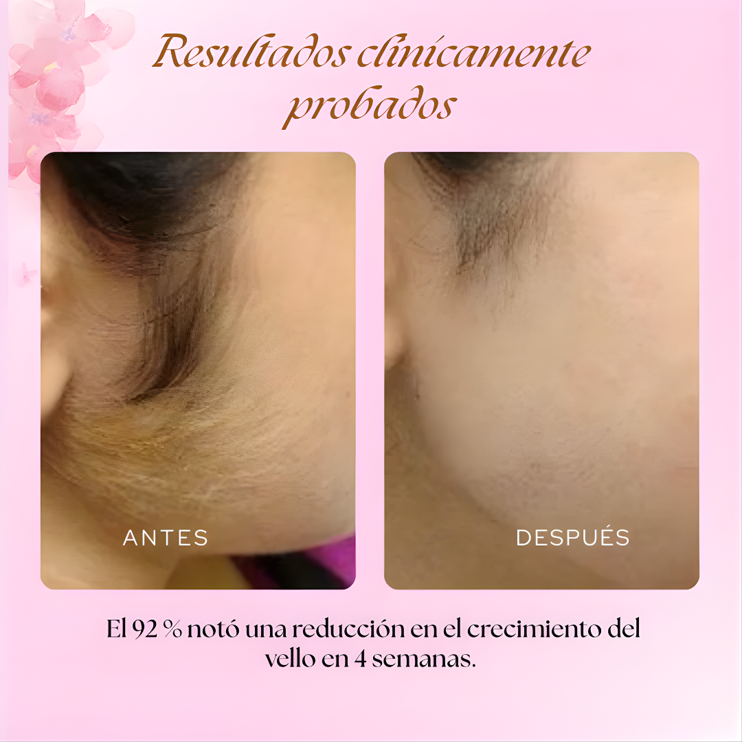 CYPERUS ROTUNDUS HAIR REMOVAL – Apoyo natural para reducir el crecimiento del vello y cuidar tu piel