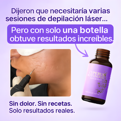CYPERUS ROTUNDUS SKIN SERUM – Piel más uniforme, cuidado avanzado y luminosidad visible