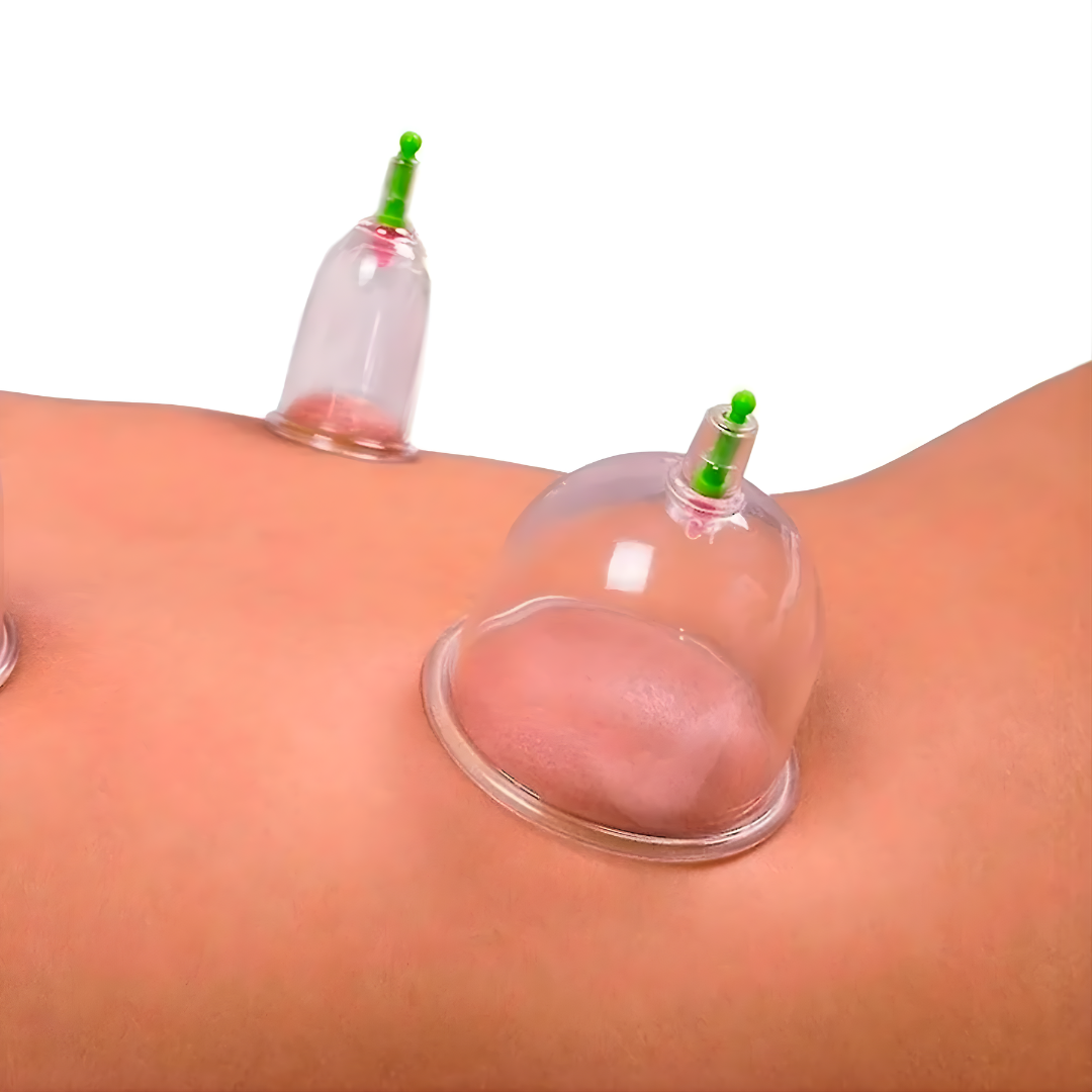 SET DE VENTOSAS – Estimulación localizada, activación circulatoria y cuidado corporal en casa