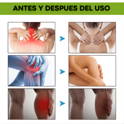 BEEVANA – Alivio reconfortante, sensación térmica y apoyo para el bienestar articular