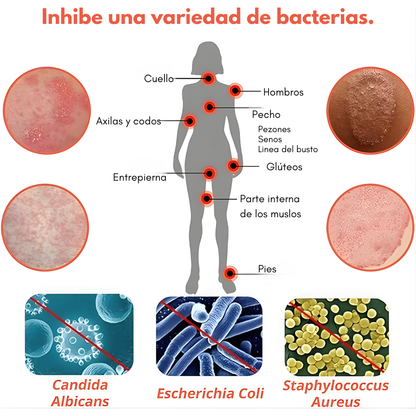 CREMA ANTIPICAZÓN – Alivio instantáneo para tu piel