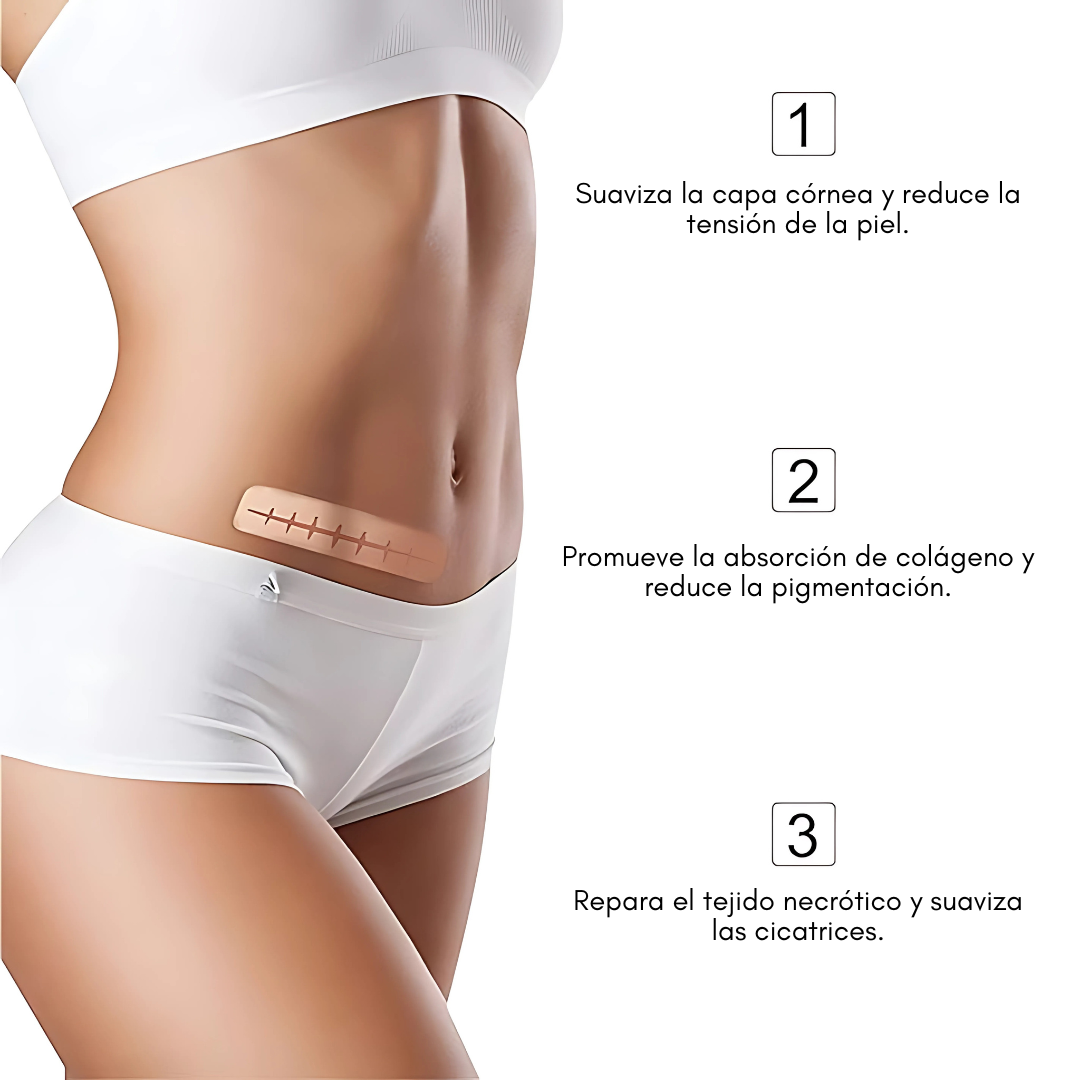 CINTA DE SILICONA PARA ELIMINAR CICATRICES – Tratamiento efectivo para cicatrices nuevas o antiguas