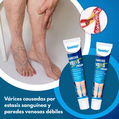 CREMA PARA VÁRICES – Alivio visible para piernas cansadas y venas marcadas