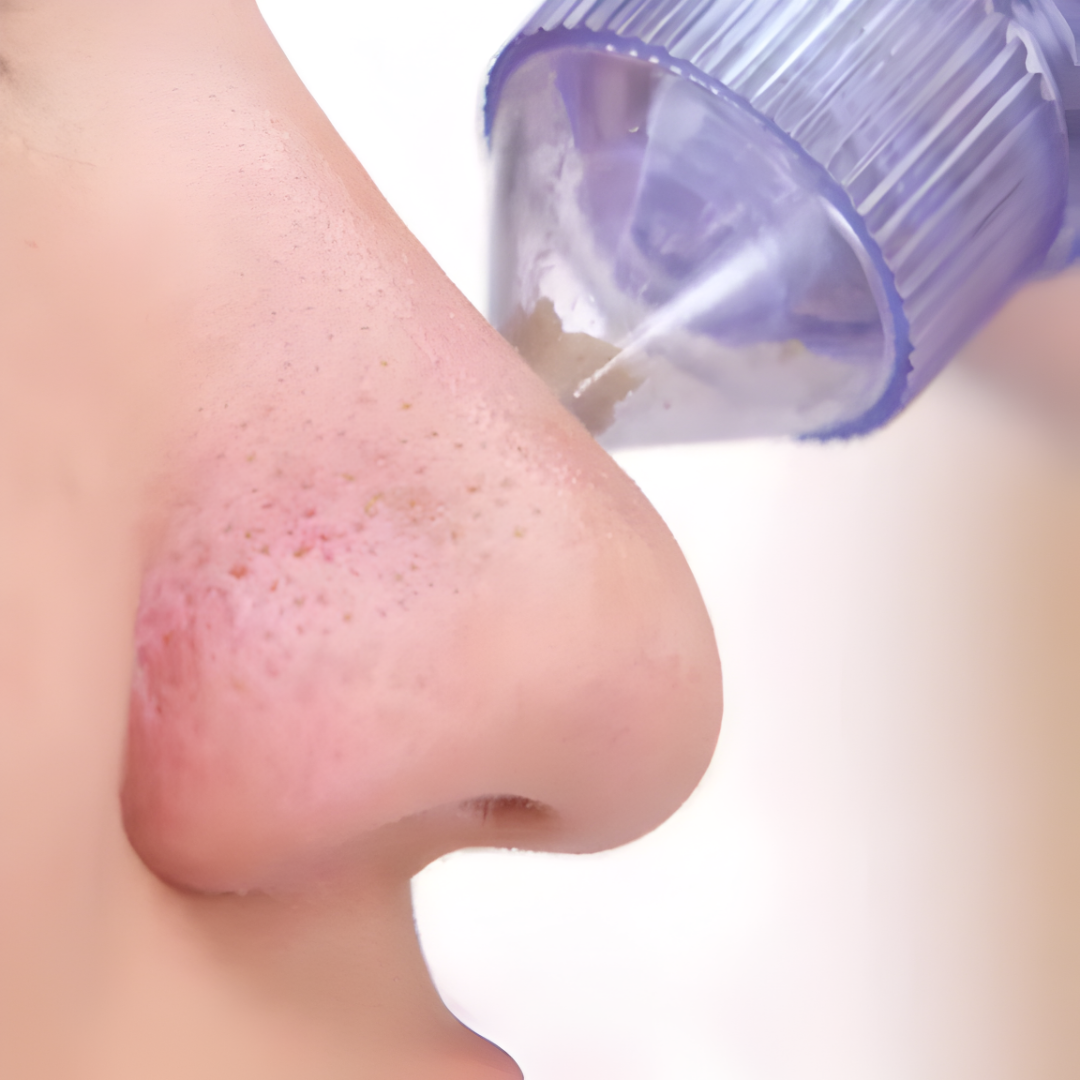 SUCCIONADOR DE PUNTOS NEGROS – Limpieza profunda de poros, piel más suave y cuidado facial desde casa