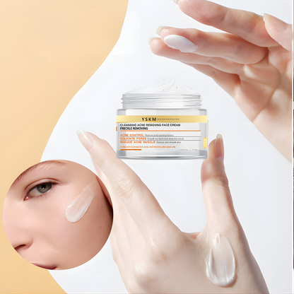 CREMA FACIAL ANTI-ACNE YSKM – Limpieza profunda, control del acné y piel más uniforme día a día
