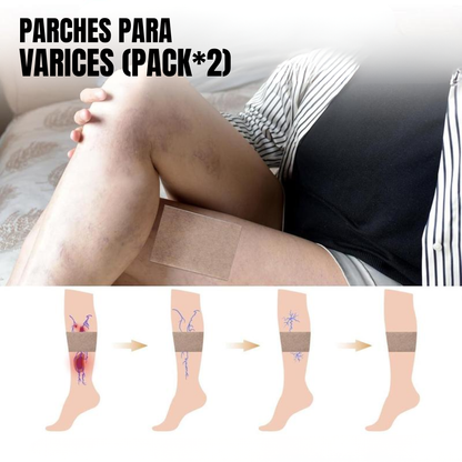 PARCHES PARA VÁRICES (PACK*2) – Alivio natural, circulación activa y piernas ligeras cada día