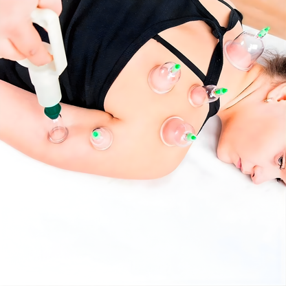 SET DE VENTOSAS – Estimulación localizada, activación circulatoria y cuidado corporal en casa
