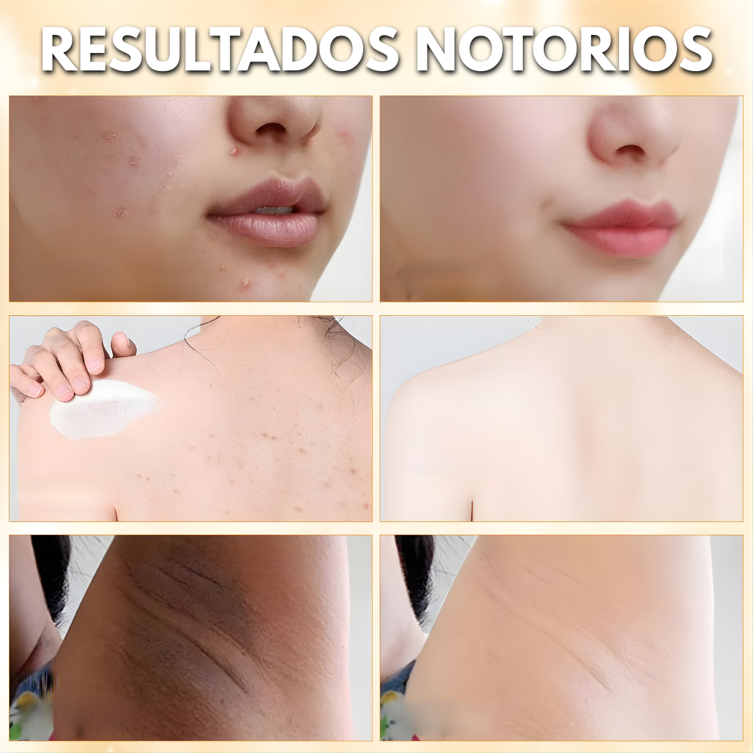 BEE VENOM – Cuidado intensivo para la piel, hidratación profunda y apariencia rejuvenecida