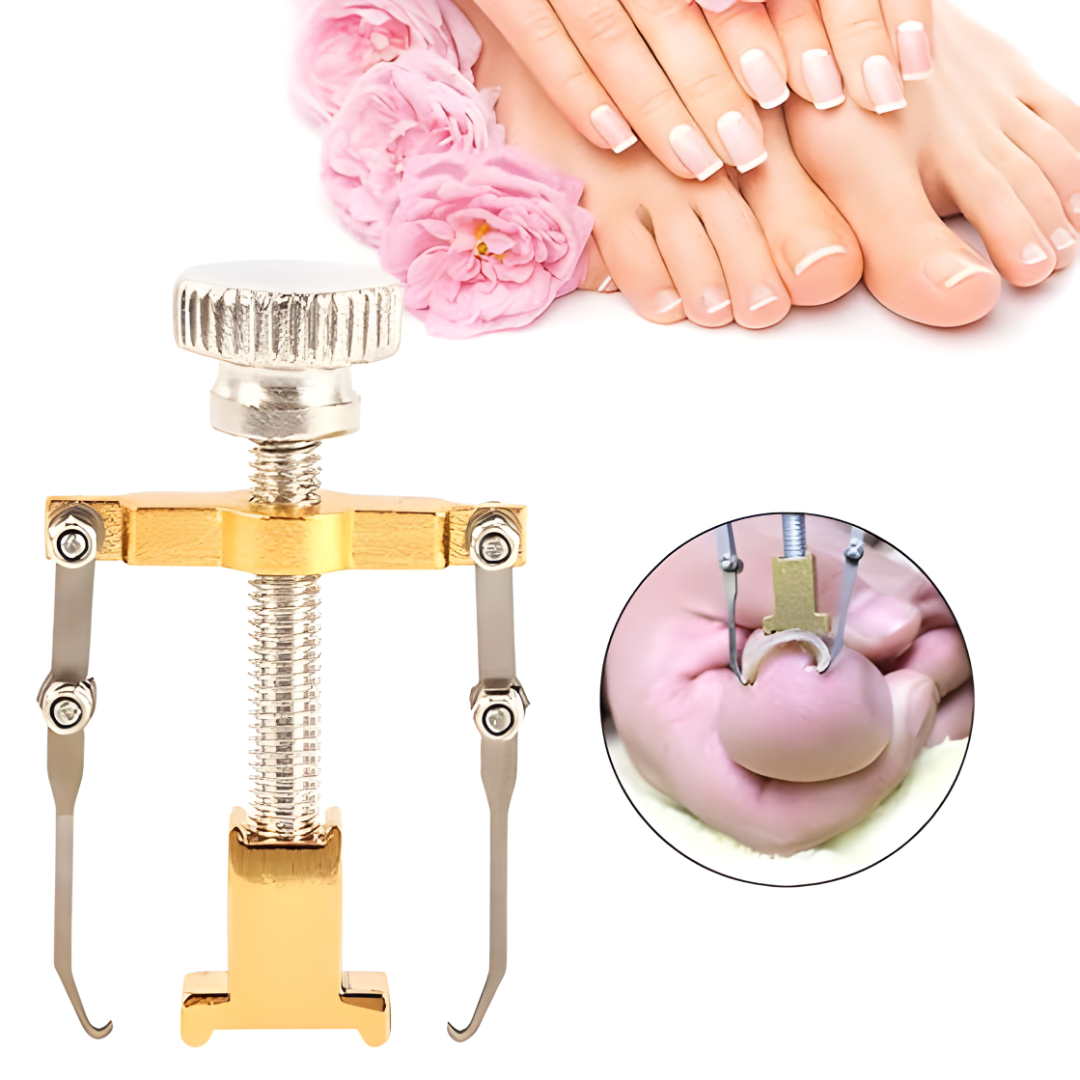 CORRECTOR DE UÑAS ENCARNADAS CON ESTUCHE METÁLICO – Alivio, precisión y cuidado profesional en casa