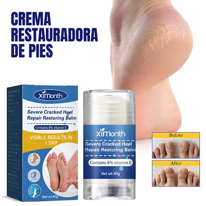 CREMA RESTAURADORA DE PIES – Talones suaves, piel renovada