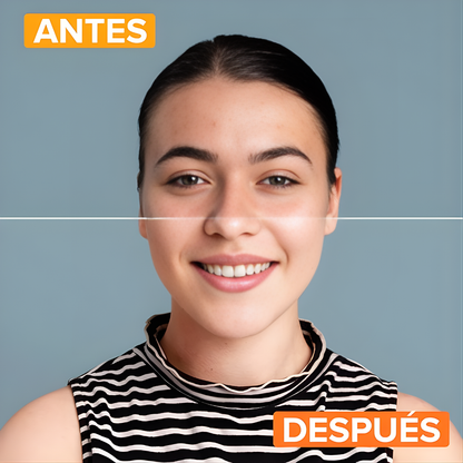 BIOAQUA ANTI-ACNE CAJA BLANCA – Control total del acné y renovación profunda de la piel