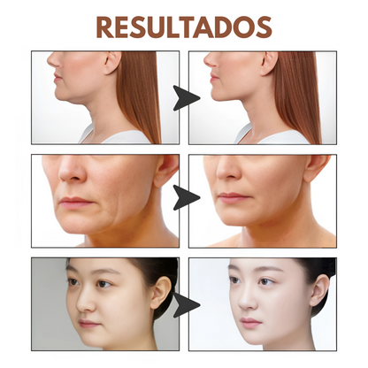 LIFT TAPE FACIAL (PACK X2) – Efecto lifting instantáneo sin cirugía ni dolor