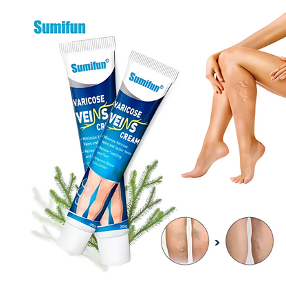 CREMA PARA VÁRICES – Alivio visible para piernas cansadas y venas marcadas