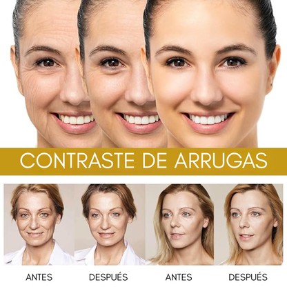 SUERO RESTAURADOR DE ABEJA – Regenera, reafirma y rejuvenece tu piel naturalmente