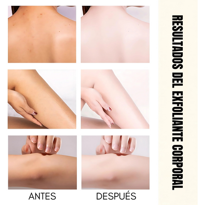 EXFOLIANTE DE ARROZ PARA CUERPO Y ROSTRO – Piel suave, limpia y luminosa naturalmente