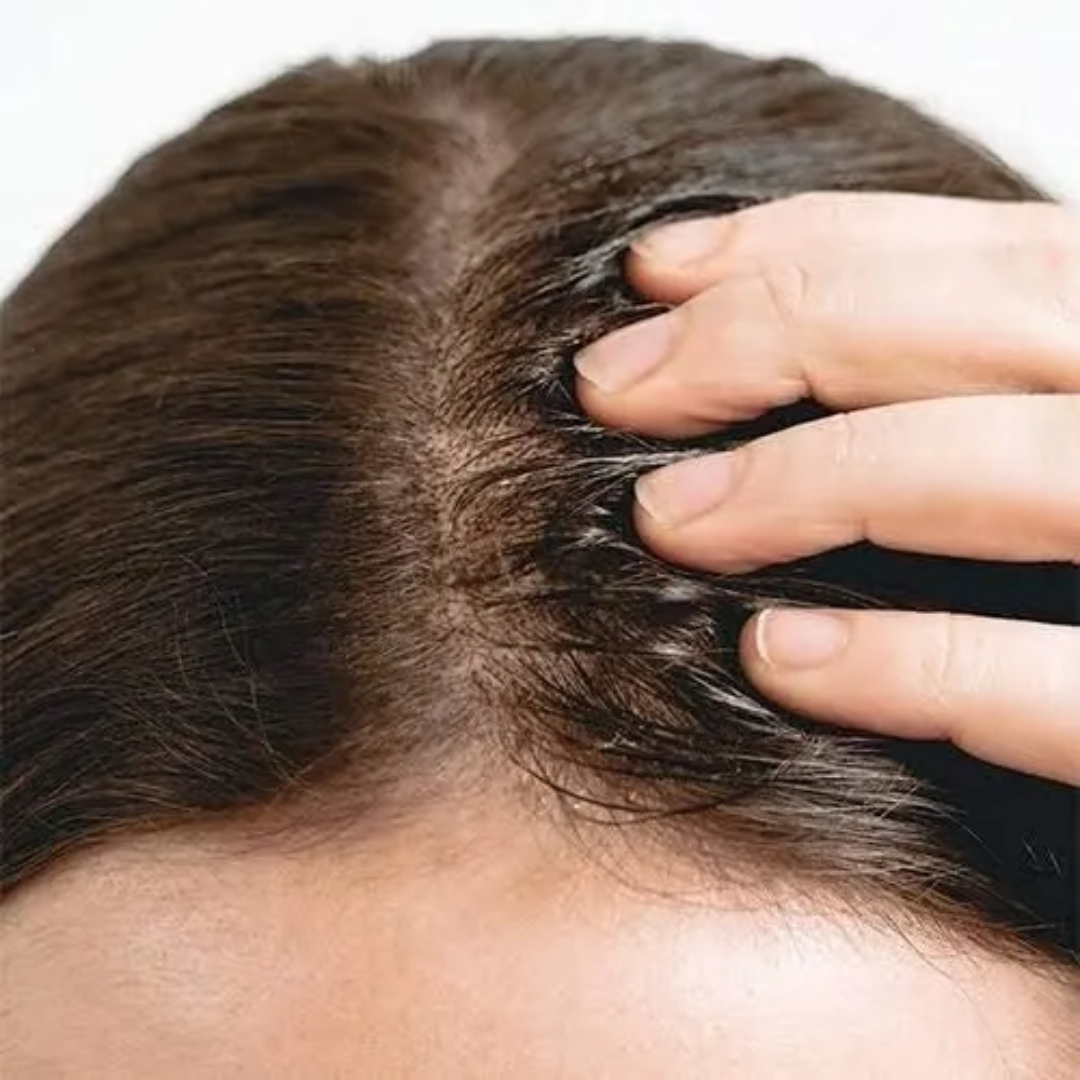 MULTI-PEPTIDE – Fortalece, estimula y recupera la densidad natural de tu cabello