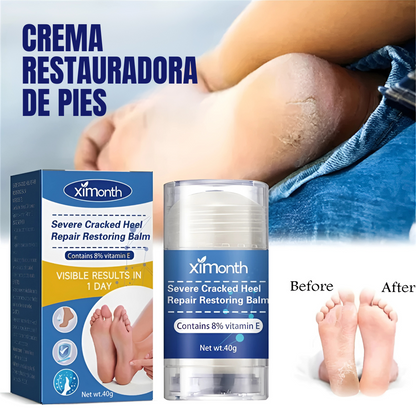 CREMA RESTAURADORA DE PIES – Talones suaves, piel renovada