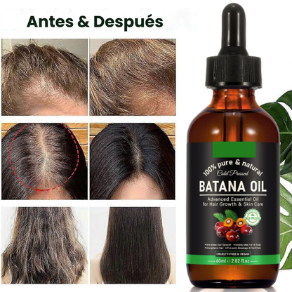 ACEITE DE BATANA – Reparación profunda, crecimiento fortalecido y brillo natural para todo tipo de cabello