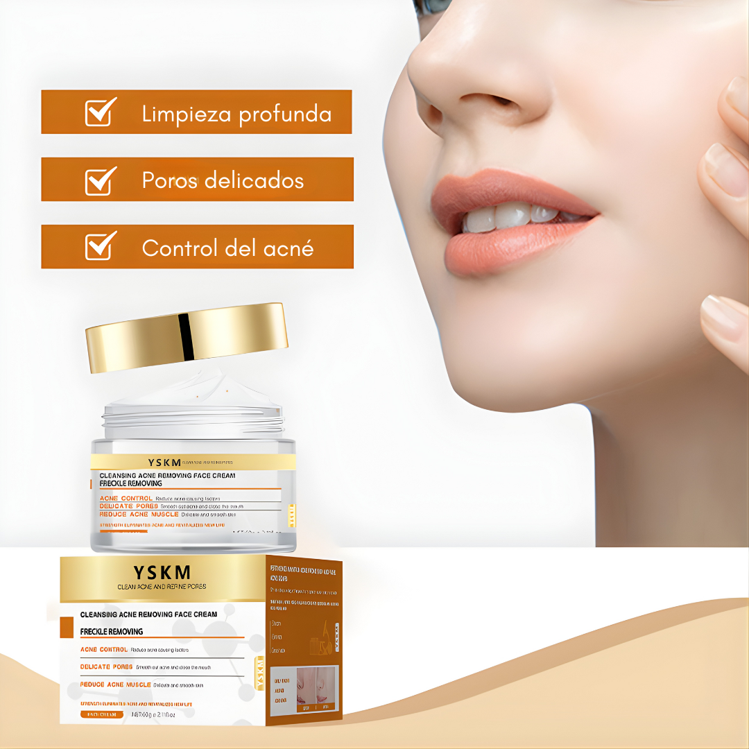 CREMA FACIAL ANTI-ACNE YSKM – Limpieza profunda, control del acné y piel más uniforme día a día
