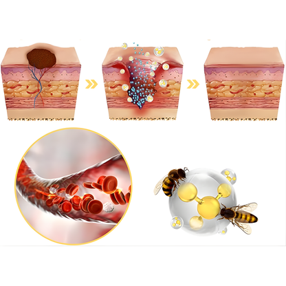 CREMA DE VENENO DE ABEJA PARA REMOVER VERRUGAS, LUNARES, MANCHAS EN LA PIEL – Corrección avanzada, renovación visible y piel más uniforme cada día