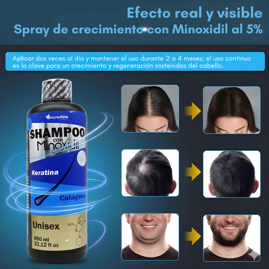 SHAMPOO MINOXIDIL – Fortalecimiento capilar, apariencia de mayor densidad y cuidado diario para tu cabello