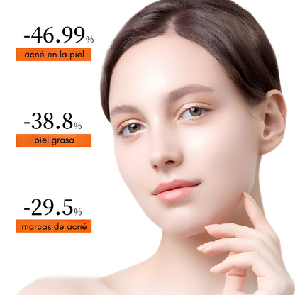 CREMA FACIAL ANTI-ACNE YSKM – Limpieza profunda, control del acné y piel más uniforme día a día