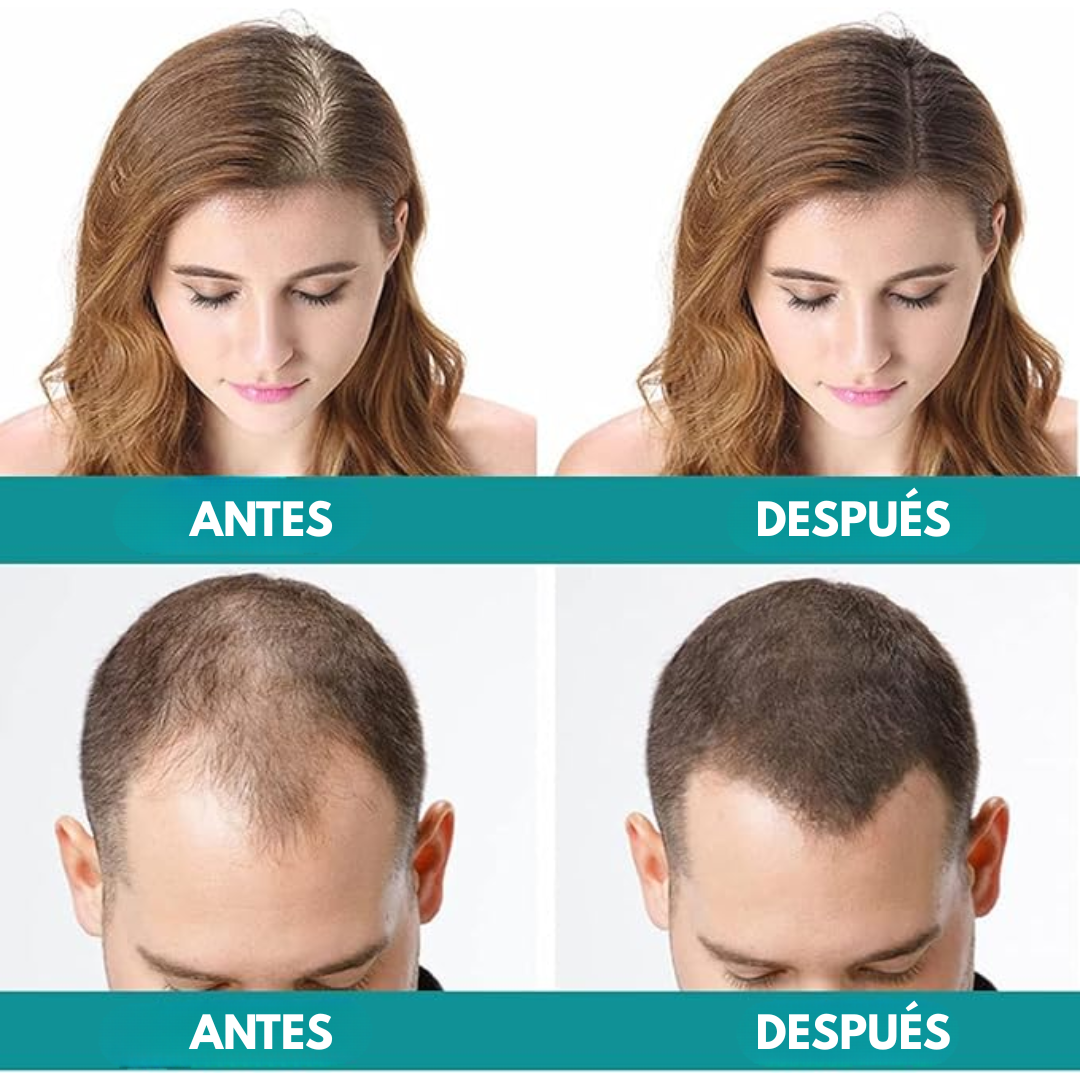 MULTI-PEPTIDE – Fortalece, estimula y recupera la densidad natural de tu cabello