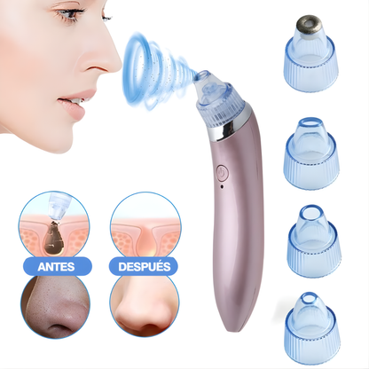 SUCCIONADOR DE PUNTOS NEGROS – Limpieza profunda de poros, piel más suave y cuidado facial desde casa