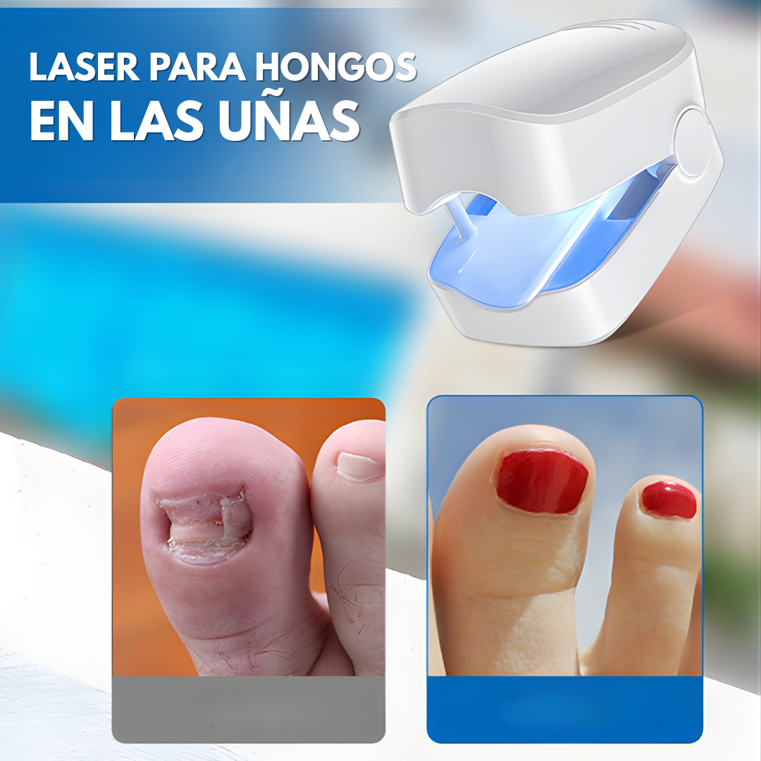 LÁSER PARA HONGOS EN LAS UÑAS – Tratamiento preciso, alivio duradero y tecnología profesional para recuperar uñas saludables