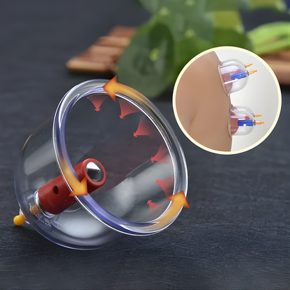 SET DE VENTOSAS – Estimulación localizada, activación circulatoria y cuidado corporal en casa