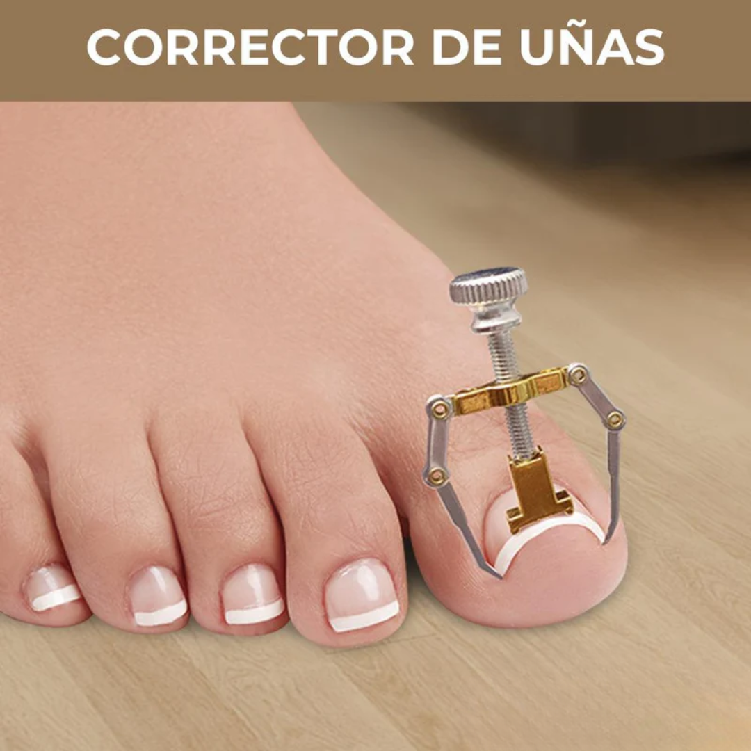 CORRECTOR DE UÑAS ENCARNADAS CON ESTUCHE METÁLICO – Alivio, precisión y cuidado profesional en casa
