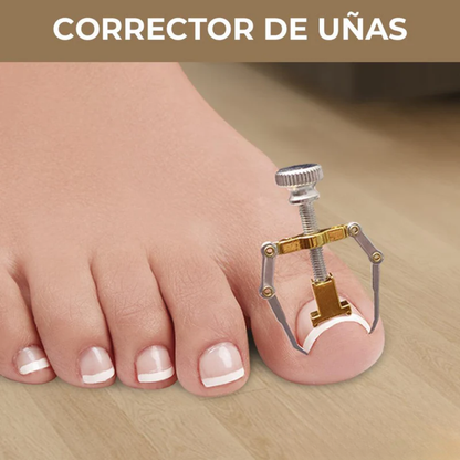 CORRECTOR DE UÑAS ENCARNADAS CON ESTUCHE METÁLICO – Alivio, precisión y cuidado profesional en casa