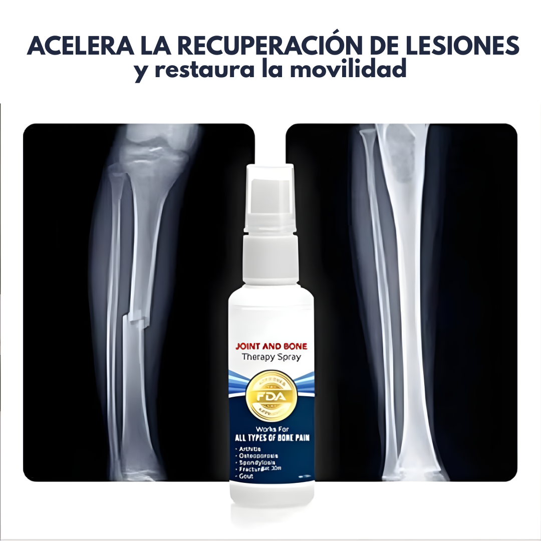 SPRAY PARA DOLOR DE ARTICULACIONES – Alivio rápido, profundo y natural en cada aplicación