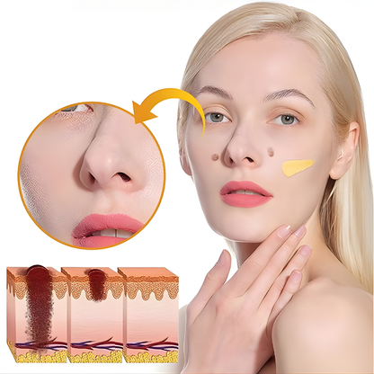 CREMA DE VENENO DE ABEJA PARA REMOVER VERRUGAS, LUNARES, MANCHAS EN LA PIEL – Corrección avanzada, renovación visible y piel más uniforme cada día