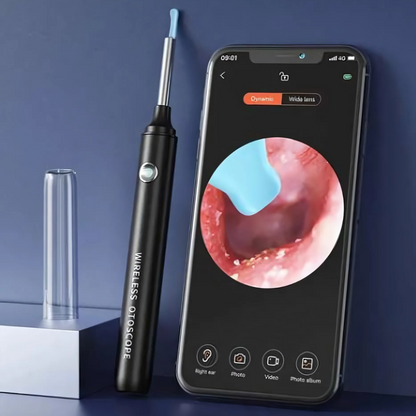 Limpiador EarViz™ - Ve lo que nunca antes pudiste ver... y límpialo sin riesgos.